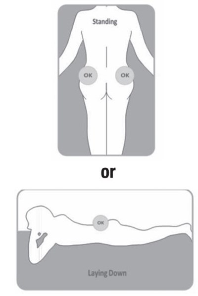 Lanreotide fig 5 - Lanreotide fig 5